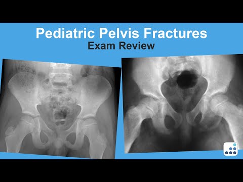 Pediatric Pelvic Fractures Exam Review - Lindsay Andras, MD