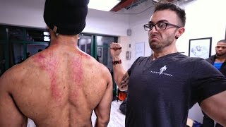HOW TO FIX YOUR POSTURE (ROUNDED SHOULDER PAIN)