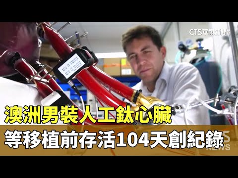 澳洲男裝人工鈦心臟　等移植前存活104天創紀錄