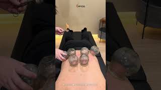 Download lagu Cupping Therapy for Lower Back Pain #sakitpinggang #tcm #cuppingtherapy #bekam #kelapagading mp3 Download lagu Cupping Therapy for Lower Back Pain #sakitpinggang #tcm #cuppingtherapy #bekam #kelapagading mp3