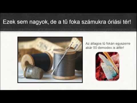 pikkelysömör tüneteinek kezelése a pikkelysömör egyéb formái