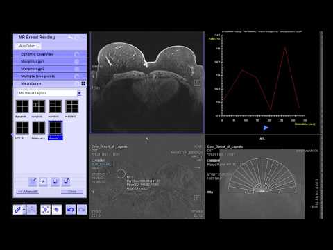 Mean Curve Evaluation