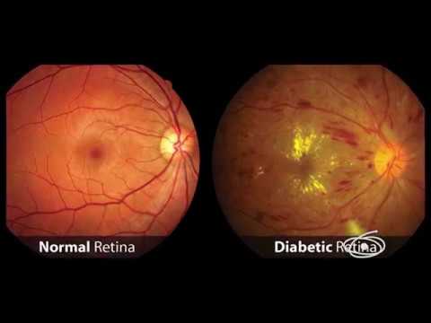 CAPES - Coordenação de Aperfeiçoamento de Pessoal de Nível 