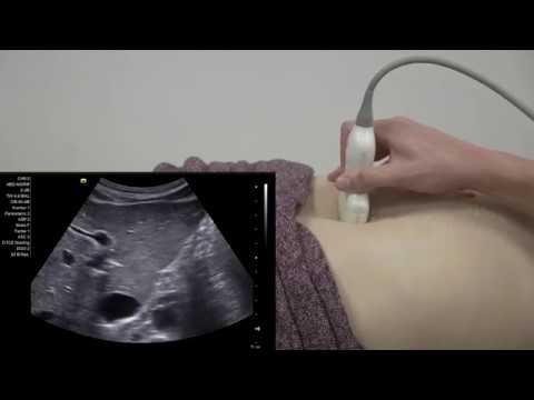 Abdomensonografie - Leberpforte