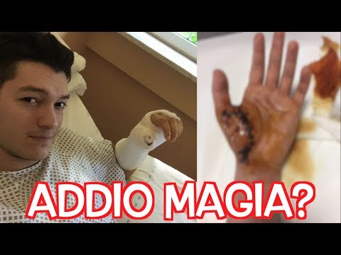 Dolore cintura nella parte posteriore del mattino Tira larticolazione della mano sinistra