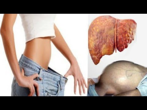 Cara efektif membakar perut pria gemuk Suplemen makanan Cina untuk menurunkan berat badan toko online