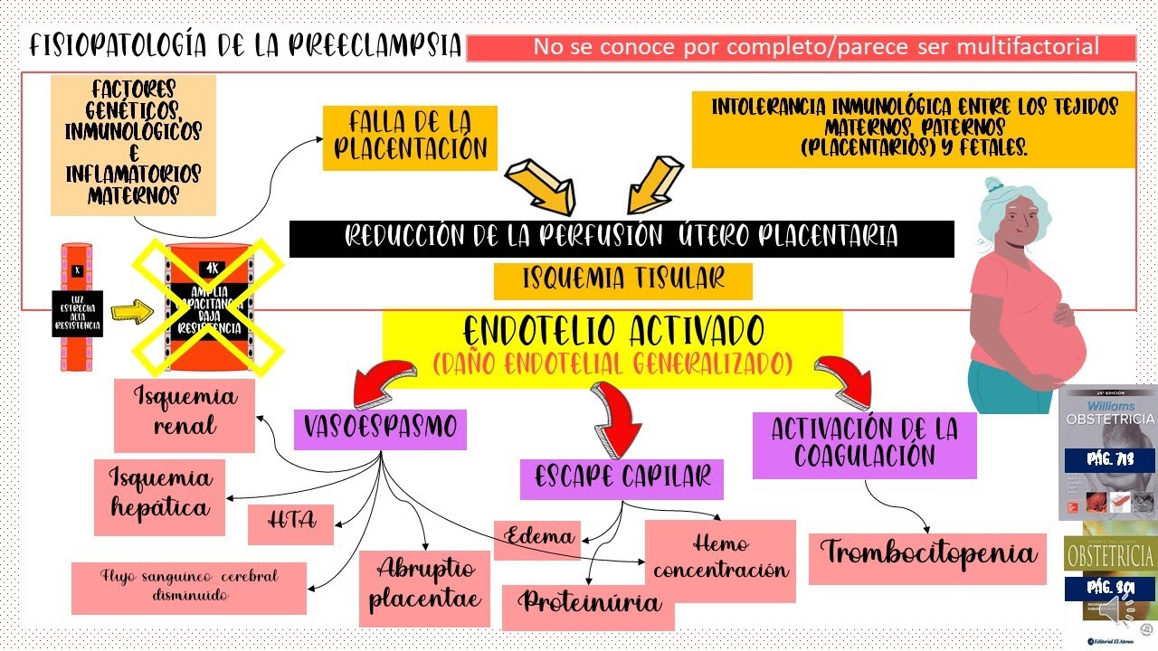 Fisiopatología de la Preeclampsia actualizado