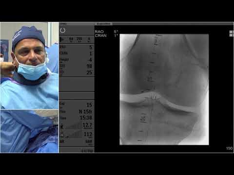 LC # 8 - SFA ISR CTO - LINC 2019