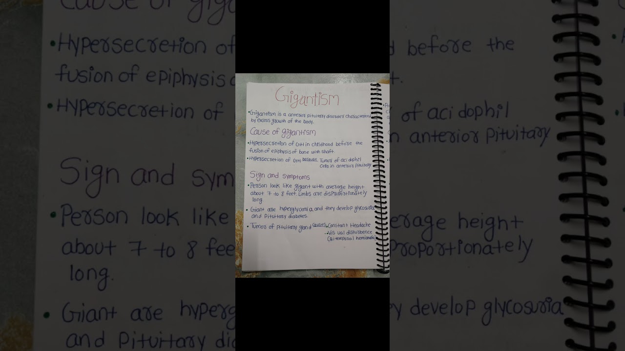 #NOTES 📝# GIGANTISM - ANTERIOR PITUITARY DISORDER # ENDOCRINE SYSTEM # PHYSIOLOGY # FOR MEDICAL STU.