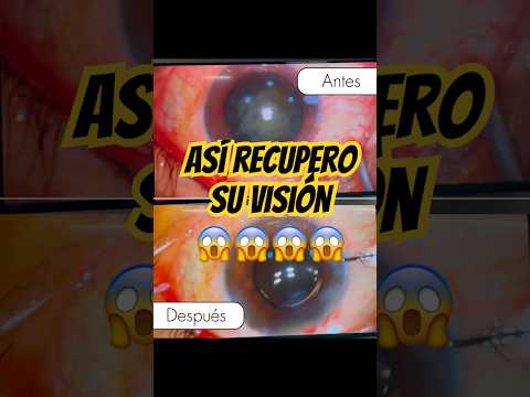 Miguel Ángel Pinedo Saboya-39