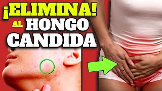 ¡IMPRESIONANTE!: Así DESTRUIS a la CANDIDA de tu CUERPO| NUNCA MÁS TENDRÁS CANDIDIASIS