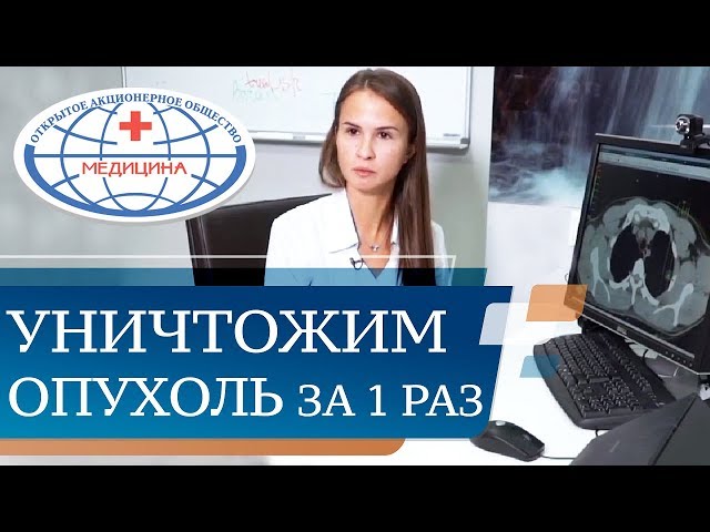 Лечение Плоскоклеточного Рака Облучение