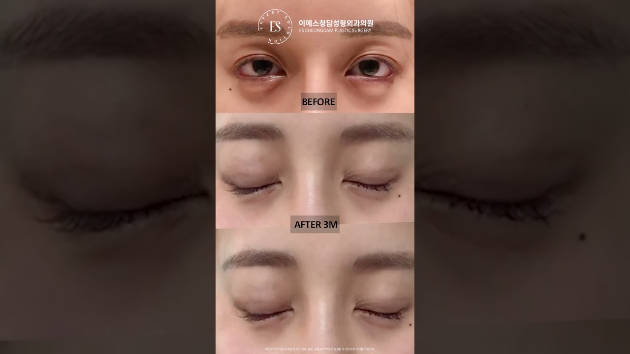 이에스 유튜브