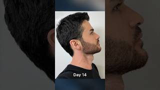Download lagu Beard Growth time lapse β³β¨ mp3 Download lagu Beard Growth time lapse β³β¨ mp3