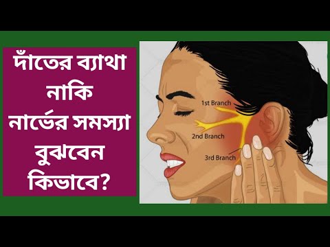 How to tell if it's a toothache or a nerve problem || What to do for toothache || Dental Care BD