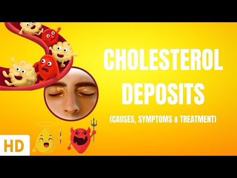 All About Allergy Shots