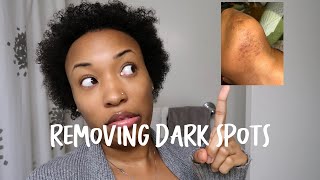 How to Clear Up Dark Spots | Removing Dark Spots on Your Face | Earthen Escapes Dark Spot Corrector
