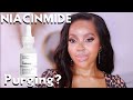 WHY THE ORDINARY NIACINAMIDE 10 ZINC 1 CAUSES BREAKOUTS OR PURGING THE TRUTH ABOUT ORDINARY