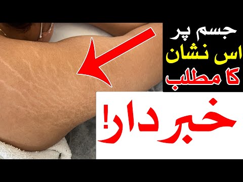 Jism Par In Nishan Ka Matlab ilm e Jafar astrology ilm e Najoom Mehrban Ali Marks on the body Til