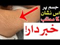 Jism Par In Nishan Ka Matlab Ilm E Jafar Astrology Ilm E Najoom Mehrban Ali Marks On The Body Til