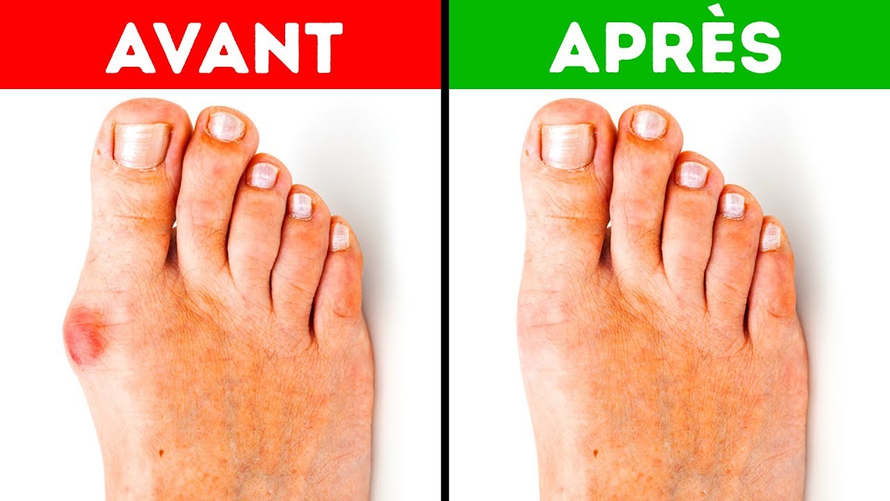 5 Manières Efficaces de se Débarrasser Des Oignons