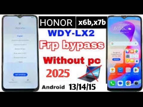 FRP Bypass Honor X6B / X7B Without PC (2025) | 100% Working Method