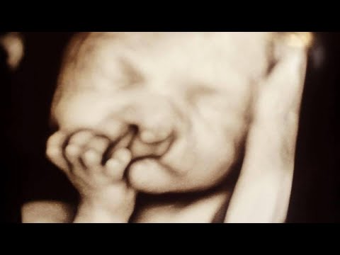 A Note Was Sent To This Baby With A Birth Defect in A Restaurant. His Mother Was Speechless!