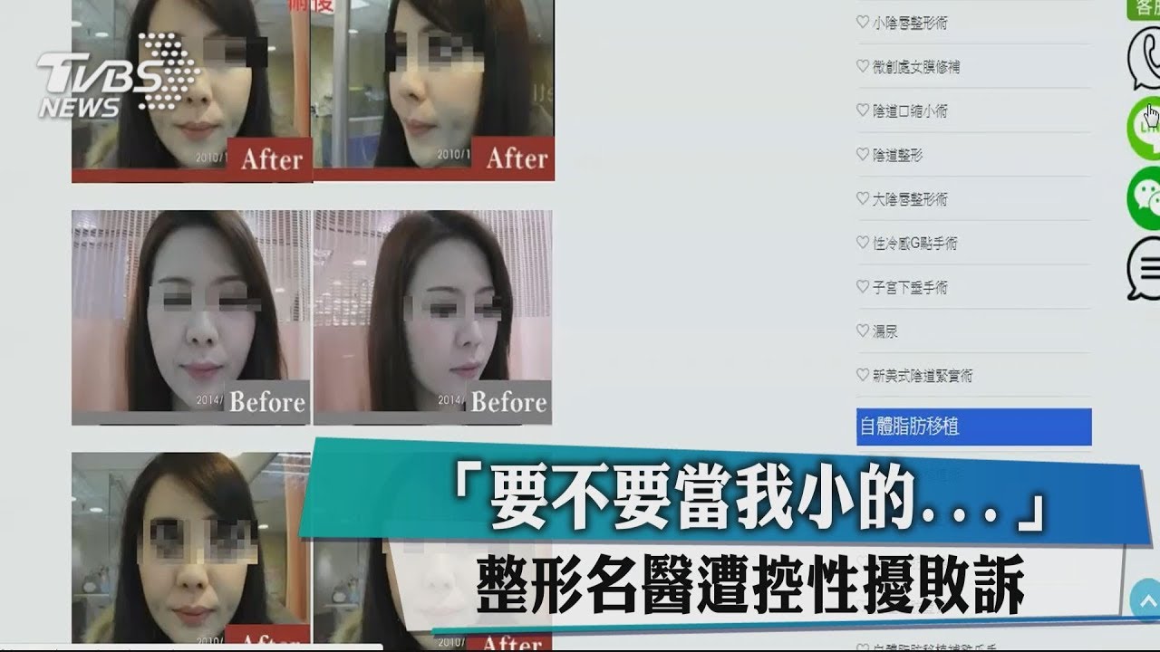 「要不要當我小的...」 整形名醫遭控性擾敗訴