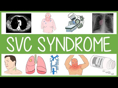 Superior Vena Cava Syndrome in 3 Minutes