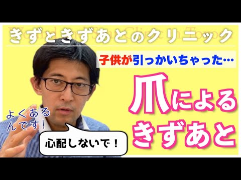 , title : 'よくある爪の引っかき傷の治療方法、ケアを教えます。'