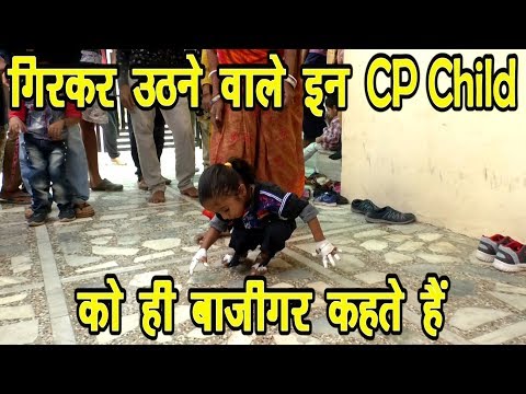 Watch lagu Images Videos Cerebral Palsy Non Progressive, Watch Images Cerebral Palsy Non Progressive free Watch Images, Watch Images Cerebral Palsy Non Progressive