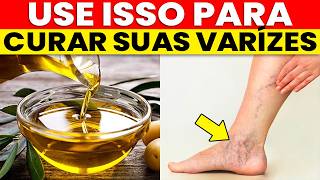 O ÓLEO Nº 1 que “Repara” as Varizes e Sela os Vazamentos