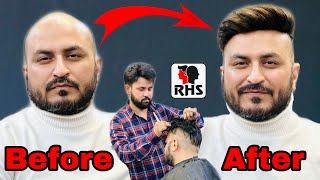 Hair Patches For Men | Hair Transformation | Hair Patch Center In India | 9599858612