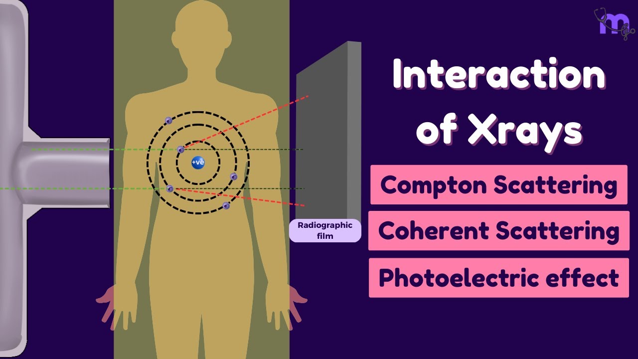 Scattering of X-rays | Compton | Coherent | Photoelectric effect | Oral radiology | Animated