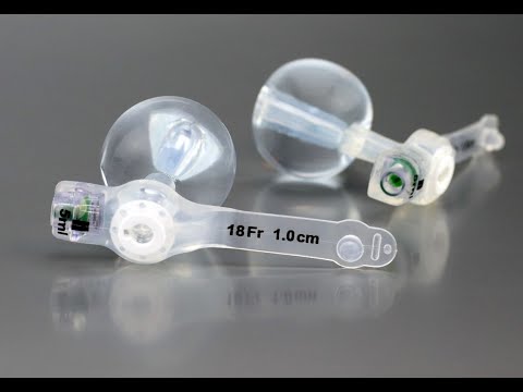 danuButton - Low profile gastrostomy button for enteral feeding
