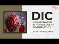 Disseminated Intravascular Coagulation Pathophysiology Diagnosis Dr Shonali Chandra