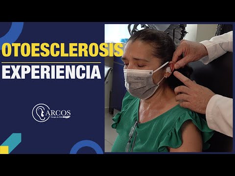 Miniatura de Cirugía de otoesclerosis - Dr. Arnulfo Cornejo Suarez