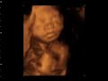 Ultrasound: baby's first smile