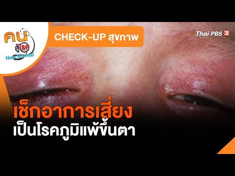 อาการ