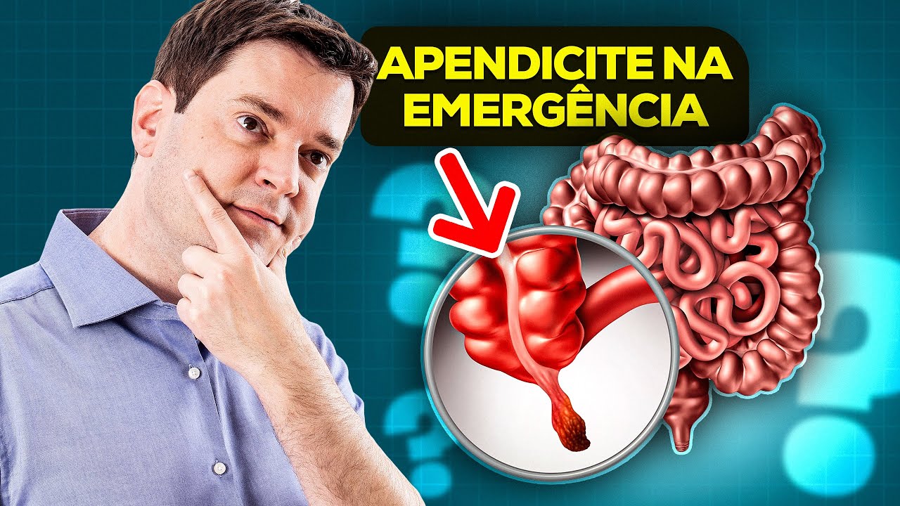 Apendicite: Diagnóstico, Tratamento Clínico e Cirúrgico - Atualização Importante!