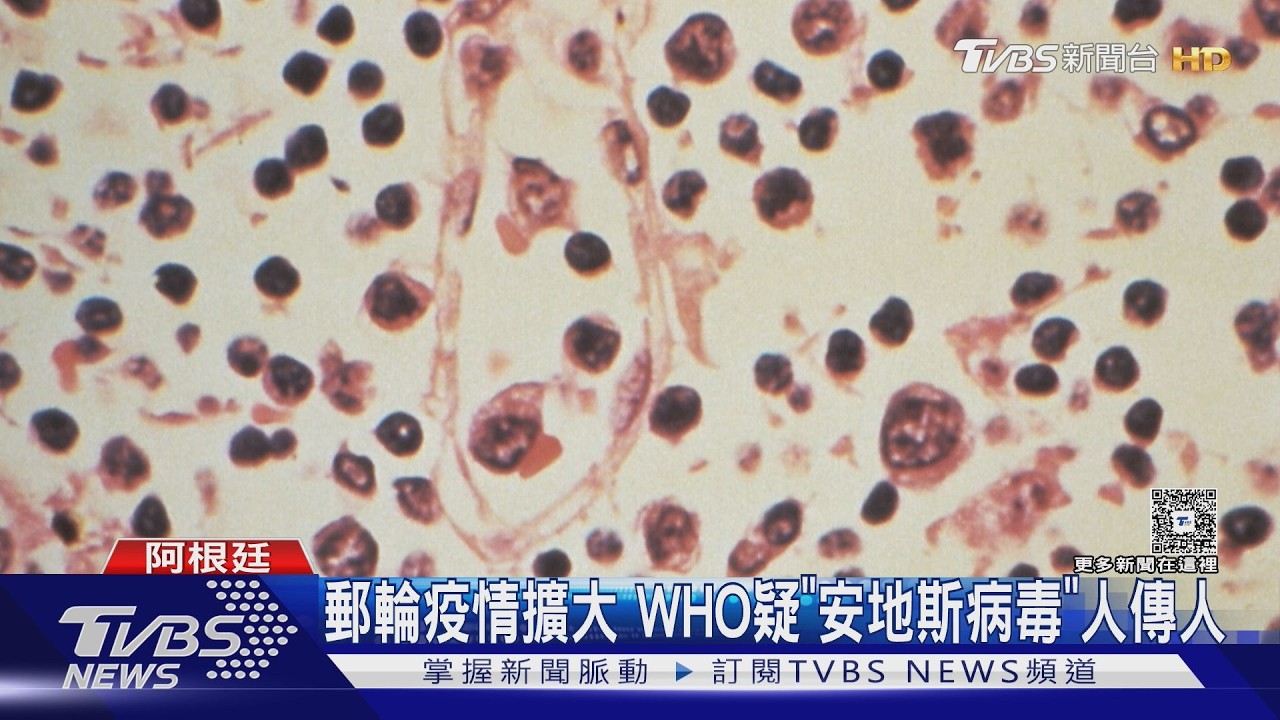 影音/郵輪漢他疫情擴大!首發病夫婦 疑登船前遭感染