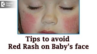 Baby cheeks red and dry in winter |Causes & Remedies - Dr. Rashmi Ravindra | Doctors
