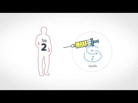 Kurz und verständlich: Diabetes behandeln - heute und morgen