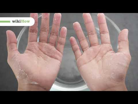 Kleber Von Den Händen Entfernen