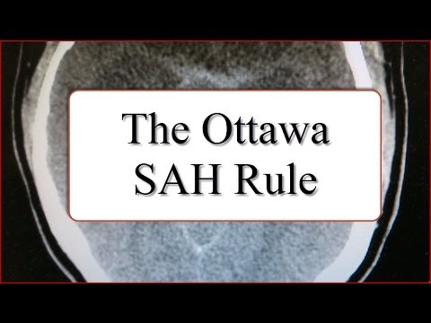 The Ottawa SAH Rule