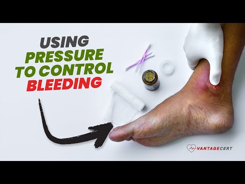 Using Direct Pressure to Control Bleeding | First Aid Care For Blood Emergencies