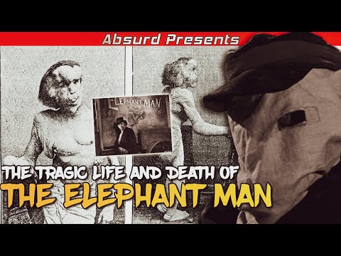 The Tragic Life And Death Of The Elephant Man