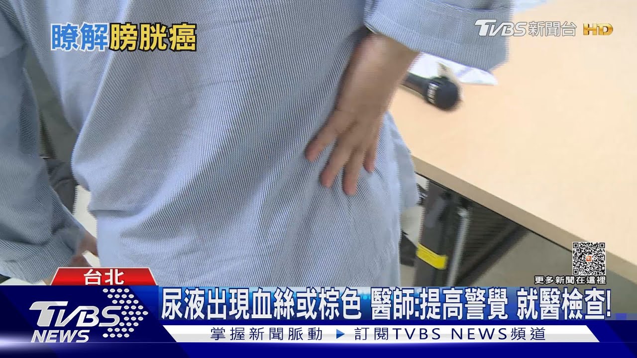 輕忽血尿下場慘!醫師:不排除罹「這種癌」發現晚治療很棘手