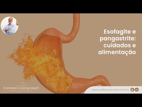 Esofagite e pangastrite: cuidados e alimentação | Prof. Dr. Luiz Carneiro CRM 22761