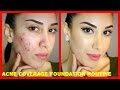 Acne Coverage Foundation Routine (PRE ...